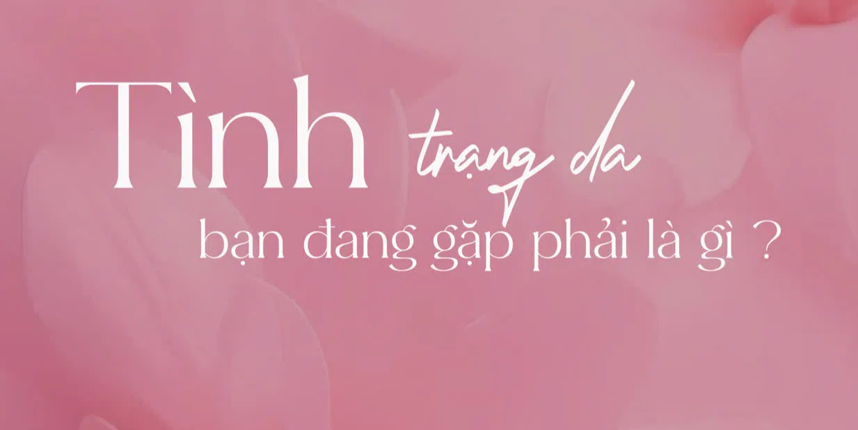 ảnh small 1