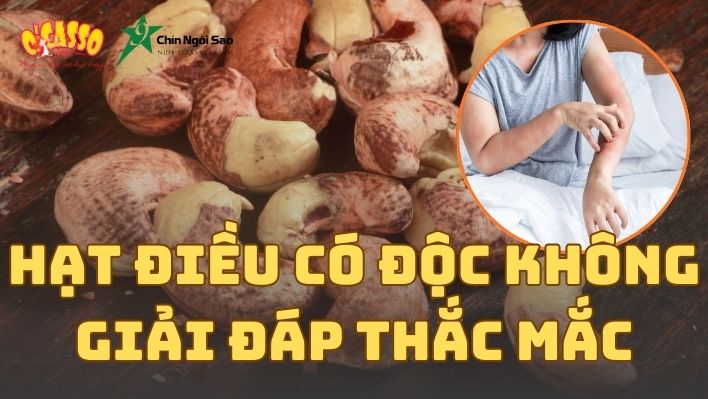 Hạt điều có độc không? Giải đáp thắc mắc cho người tiêu dùng