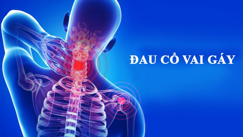 Đau Mỏi Cổ Vai Gáy Lâu Ngày: Phương Pháp Chăm Sóc Tại Trung Tâm Bodytrue Pharma Care