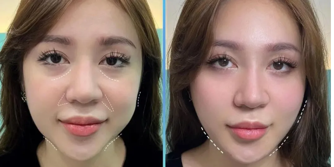 https://cdn.kiotvietweb.vn/merchant/e454f30d38e3e7d2c859589ea04fc822/cropped/1733633346/crop-file.webp